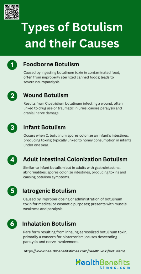 Types Of Botulism And Their Causes Health Benefits