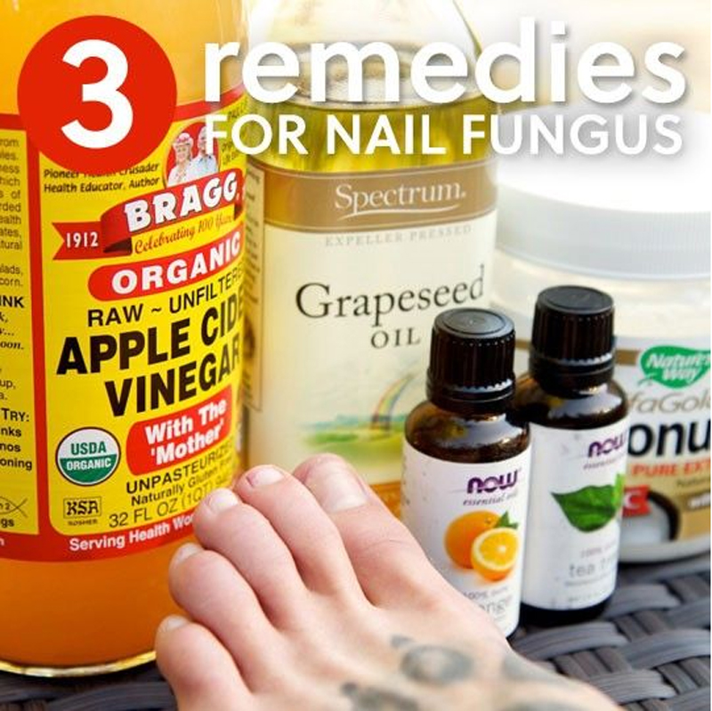 How To Treat Nail Fungus With Essential Oils At Sue Sheffield Blog