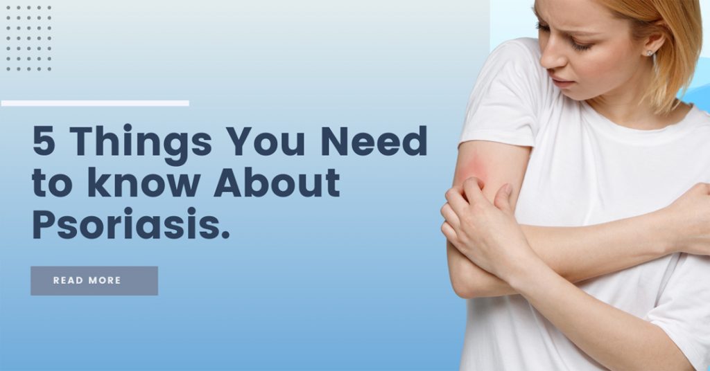 5 Things You Need to Know About Psoriasis