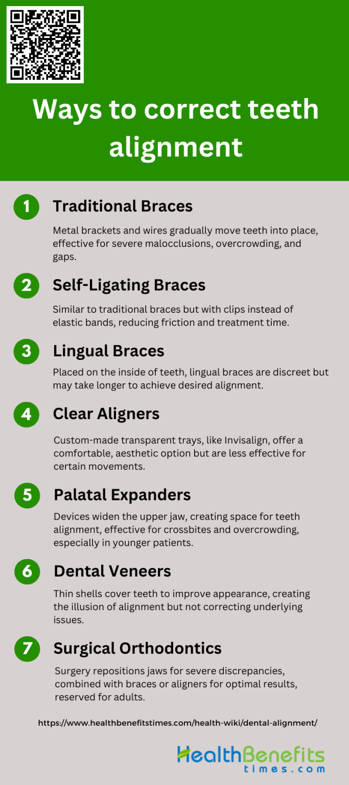 Ways to correct teeth alignment | Health Benefits