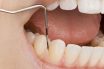 Periodontia