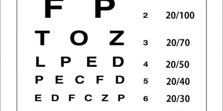 Eye Test - Definition Of Eye Test